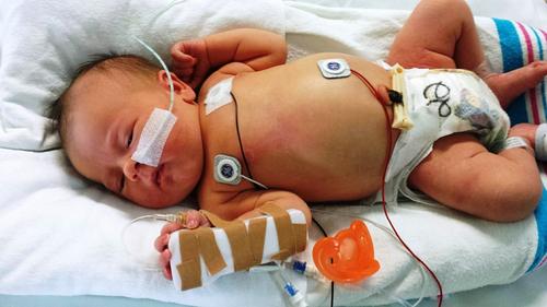 A fisioterapia e o bebê prematuro